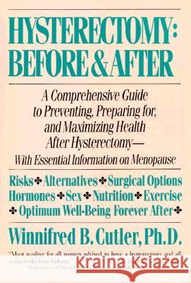 Hysterectomy Before & After: A Comprehensive Guide to Preventing, Preparing For, and Maximizing Health Winnifred B. Cutler Cutler 9780060916299 HarperCollins Publishers