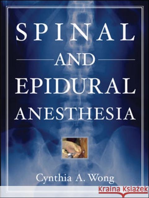 Spinal and Epidural Anesthesia Cynthia Wong 9780071437721 McGraw-Hill Professional Publishing