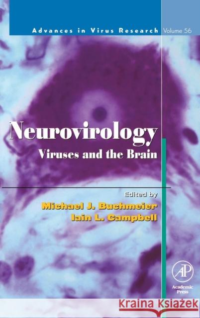 Neurovirology: Viruses and the Brain: Volume 56 Buchmeier, Michael 9780120398560 Academic Press