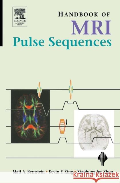 Handbook of MRI Pulse Sequences Matt A. Bernstein Kevin F. King Xiaohong Joe Zhou 9780120928613 Academic Press