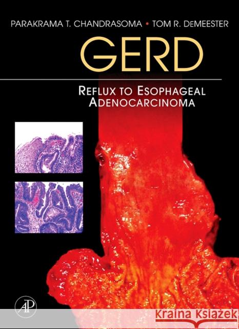 Gerd: Reflux to Esophageal Adenocarcinoma Chandrasoma, Parakrama T. 9780123694164 Elsevier Science