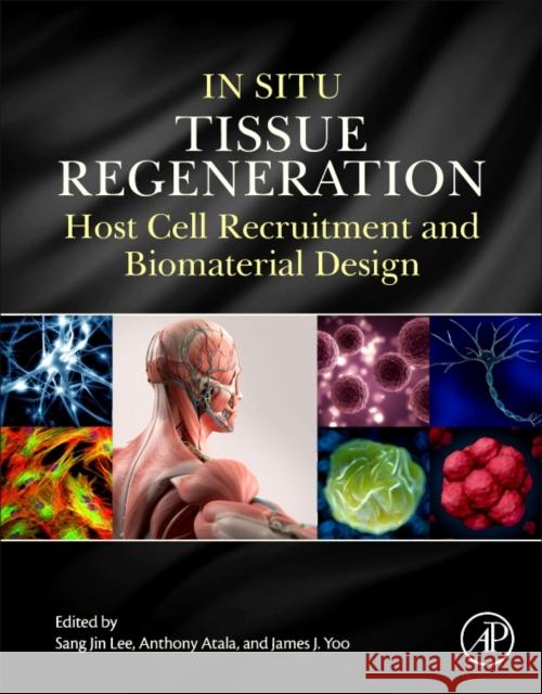 In Situ Tissue Regeneration: Host Cell Recruitment and Biomaterial Design Sang Jin Lee 9780128022252 ACADEMIC PRESS