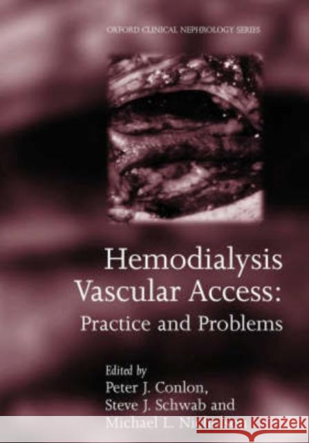Hemodialysis Vascular Access : Practice and problems Peter J. Conlon Michael L. Nicholson Steven Schwab 9780192629425 Oxford University Press, USA