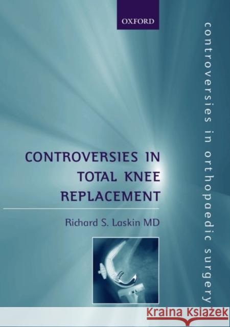 Controversies in Total Knee Replacement Richard S. Laskin 9780192630728 Oxford University Press
