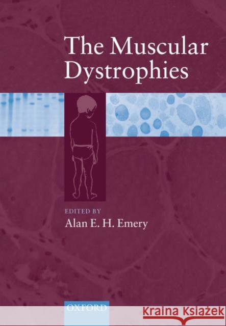 The Muscular Dystrophies Alan E. H. Emery Alan E. H. Emery 9780192632913 Oxford University Press, USA