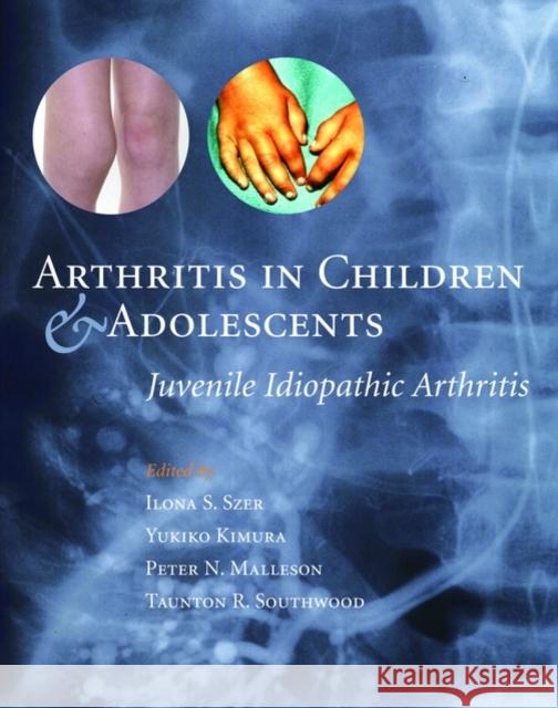 Arthritis in Children and Adolescents : Juvenile Idiopathic Arthritis Ilona S. Szer Yukiko Kimura Peter N. Malleson 9780192632920 Oxford University Press