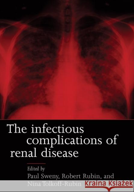 Infectious Complications of Renal Disease Herman Melville Paul Sweny Nina Tolkoff-Rubin 9780192632944 Oxford University Press, USA