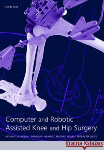 Computer and Robotic Assisted Hip and Knee Surgery Anthony Digioia Branislav Jaramaz Frederick Picard 9780198509431 Oxford University Press