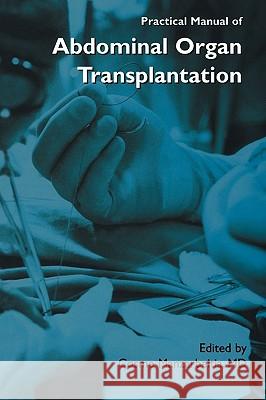 Practical Manual of Abdominal Organ Transplantation Cosme Manzarbeitia Cosme Manzarbeitia 9780306466397 Kluwer Academic Publishers