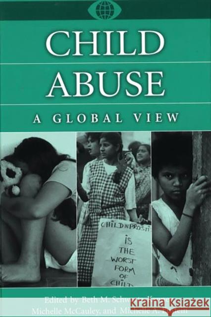 Child Abuse: A Global View Epstein, Michelle A. 9780313307454 Greenwood Press