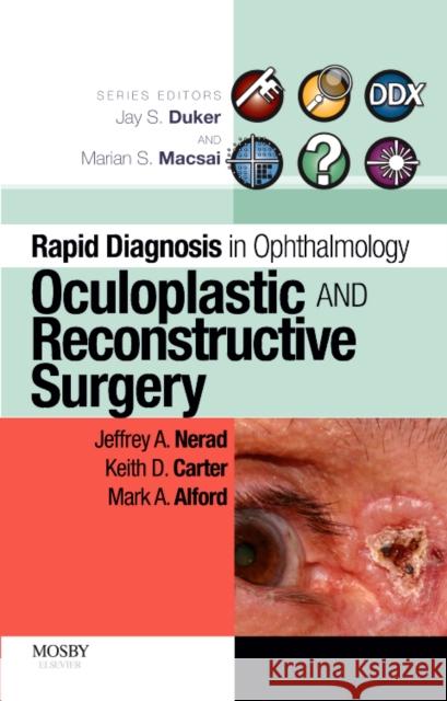 Rapid Diagnosis in Ophthalmology Series: Oculoplastic and Reconstructive Surgery Jeffrey A. Nerad Keith D. Carter Mark Alford 9780323053860 Mosby