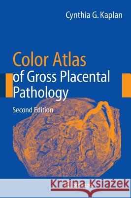 Color Atlas of Gross Placental Pathology Cynthia G. Kaplan 9780387338422 Springer