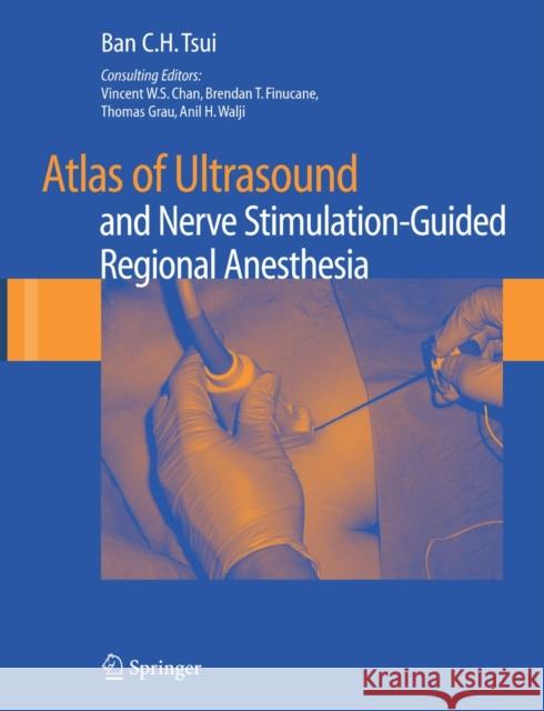 Atlas of Ultrasound and Nerve Stimulation-Guided Regional Anesthesia Chan, Vincent 9780387681580 Springer