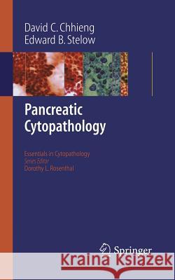 Pancreatic Cytopathology David C. Chhieng Edward B. Stelow 9780387689463 Springer