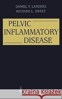 Pelvic Inflammatory Disease D. V. Landers Daniel V. Landers Richard L. Sweet 9780387944623 Springer