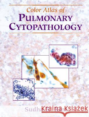 Color Atlas of Pulmonary Cytopathology Kini, Sudha R. 9780387953717 Springer