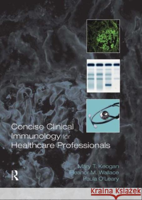 Concise Clinical Immunology for Healthcare Professionals Mary T. Keogan Paula O'Leary Eleanor M. Wallace 9780415298308 Routledge