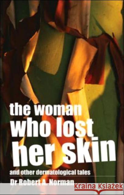The Woman Who Lost Her Skin: (And Other Dermatological Tales) Norman, Rob 9780415343565 Routledge