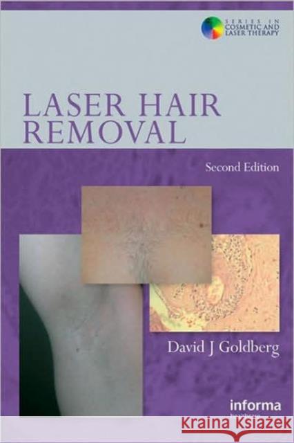 Laser Hair Removal David J. Goldberg 9780415414128 Informa Healthcare