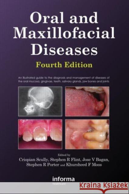 Oral and Maxillofacial Diseases, Fourth Edition Crispian Scully Stephen Flint Stephen R. Porter 9780415414944 Informa Healthcare