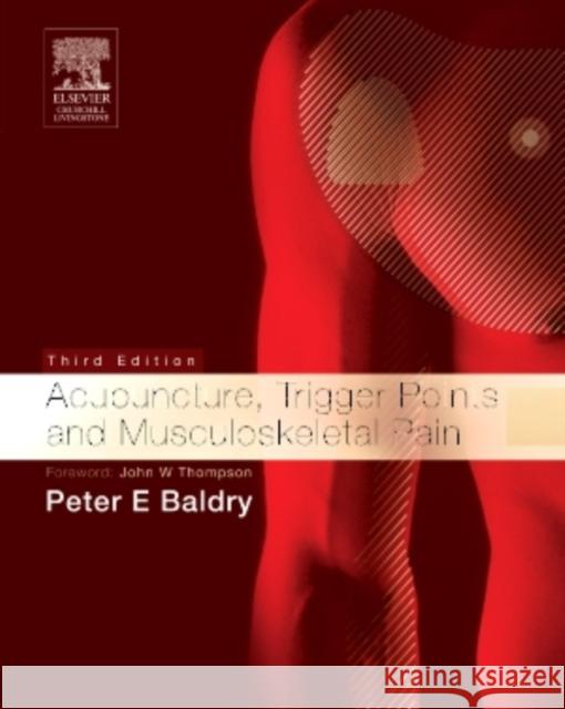 Acupuncture, Trigger Points and Musculoskeletal Pain Peter Baldry 9780443066443 Churchill Livingstone