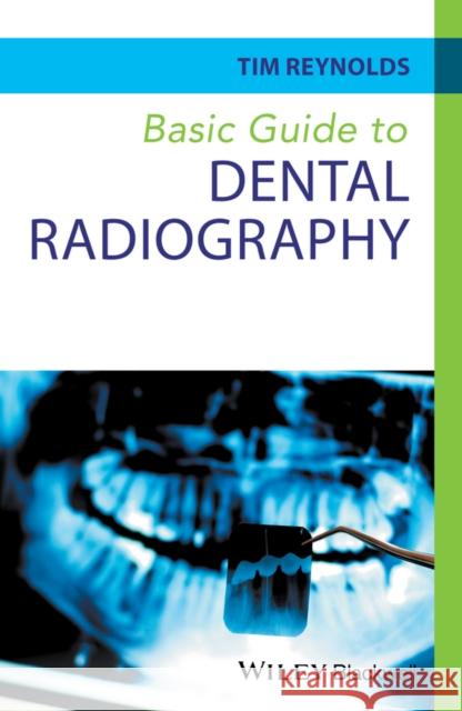 Basic Guide to Dental Radiography Reynolds, Tim 9780470673126 John Wiley & Sons