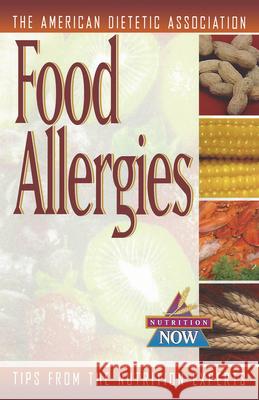 Food Allergies: The Nutrition Now Series The American Dietetic Association 9780471347149 John Wiley & Sons