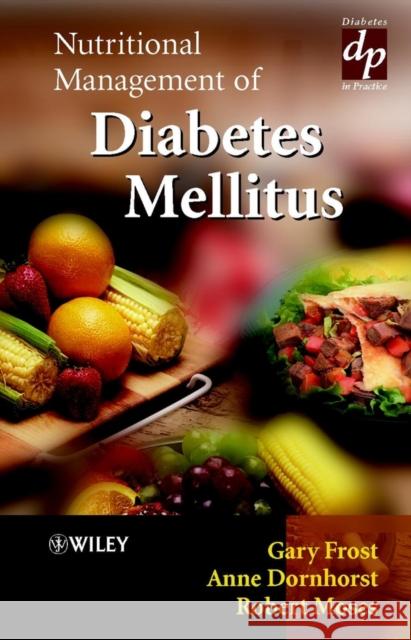 Nutritional Management of Diabetes Mellitus Gary Frost Anne Dornhorst Robert Moses 9780471497516 John Wiley & Sons