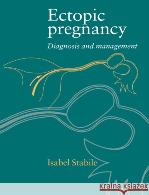 Ectopic Pregnancy: Diagnosis and Management Stabile, Isabel 9780521496124 Cambridge University Press
