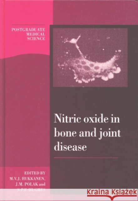 Nitric Oxide in Bone and Joint Disease M. V. J. Hukkanen S. P. Hughes J. M. Polak 9780521592208 Cambridge University Press