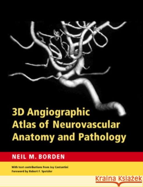 3D Angiographic Atlas of Neurovascular Anatomy and Pathology Neil M. Borden Robert F. Spetzler Jay K. Costantini 9780521856843 Cambridge University Press
