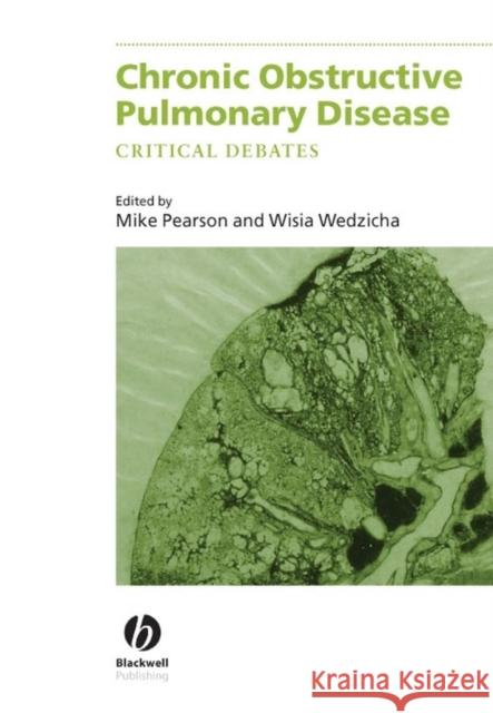 Chronic Obstructive Pulmonary Disease: Critical Debates Pearson, Michael 9780632059720 Blackwell Publishers