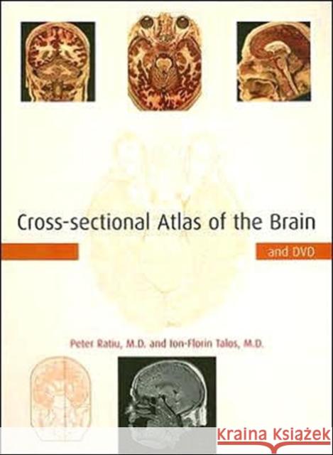 Cross-Sectional Atlas of the Brain and DVD [With DVD-ROM] Ratiu, Peter 9780674019232 Harvard University Press