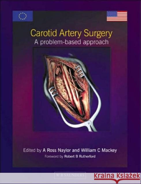 Carotid Artery Surgery : A Problem-based Approach Naylor, A. Ross, Mackey, William C. 9780702024320 Saunders Ltd.