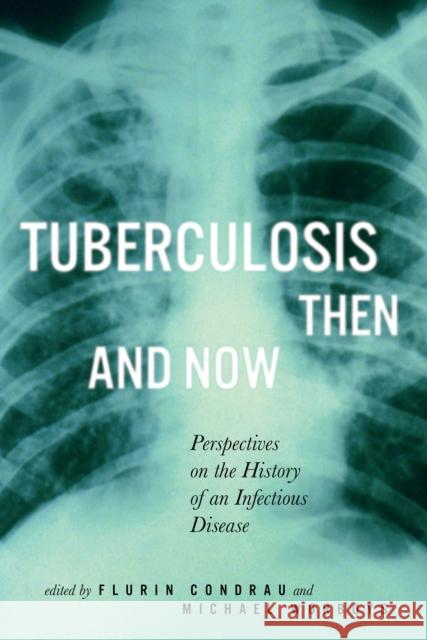 Tuberculosis Then and Now: Perspectives on the History of an Infectious Disease: Volume 36 Flurin Condrau, Michael Worboys 9780773536012 McGill-Queen's University Press