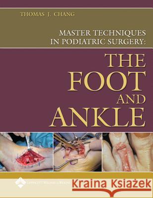 Master Techniques in Podiatric Surgery: The Foot and Ankle Thomas J. Chang 9780781732352 Lippincott Williams & Wilkins