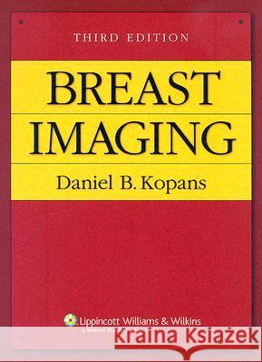 Breast Imaging Daniel B. Kopans 9780781747684 Lippincott Williams & Wilkins