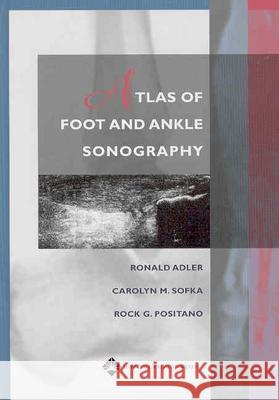 Atlas of Foot and Ankle Sonography Ronald Adler Carolyn M. Solka Rock G. Positano 9780781747691 Lippincott Williams & Wilkins