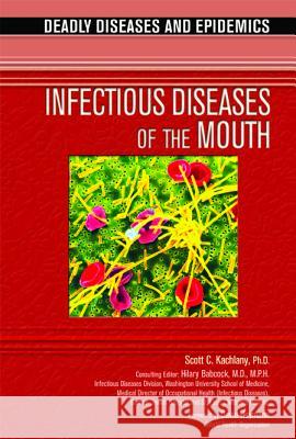 Infectious Diseases of the Mouth Scott C. Kachlany 9780791092422 Chelsea House Publications