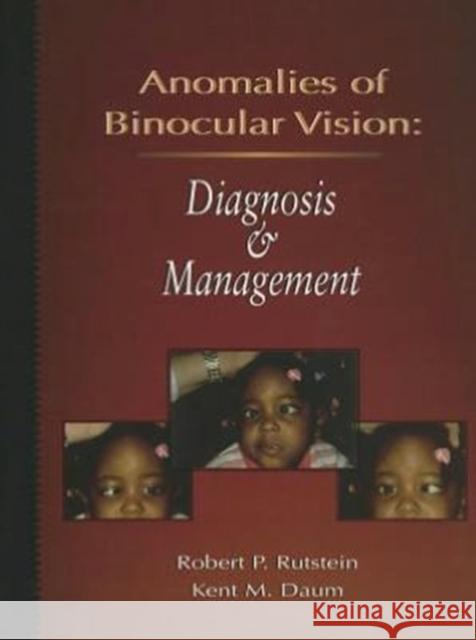 Anomalies of Binocular Vision: Diagnosis and Management Rutstein, Robert P. 9780801669163 Mosby