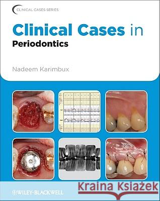 Clinical Cases in Periodontics Karimbux, Nadeem 9780813807942 Clinical Cases