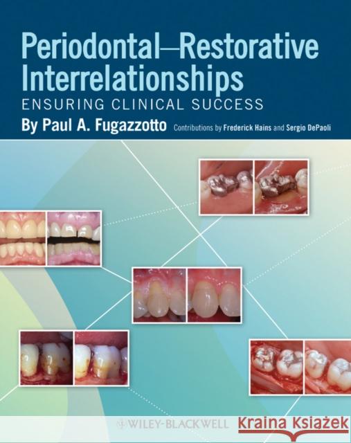 Periodontal-Restorative Interrelationships: Ensuring Clinical Success Fugazzotto, Paul A. 9780813811673 