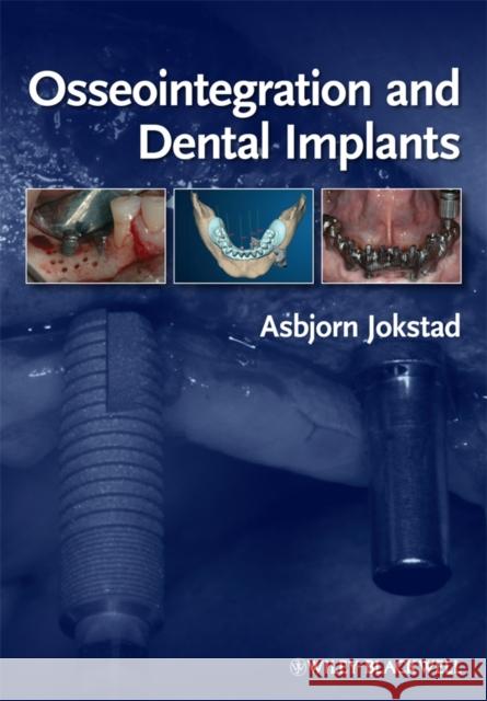 Osseointegration and Dental Implants Toronto Osseointegration Conference Revi 9780813813417 Wiley-Blackwell