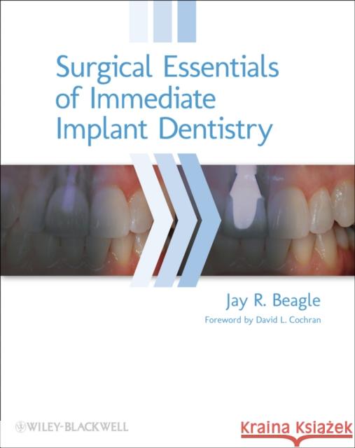 Surgical Essentials of Immediate Implant Dentistry Beagle, Jay R. 9780813816067 John Wiley & Sons