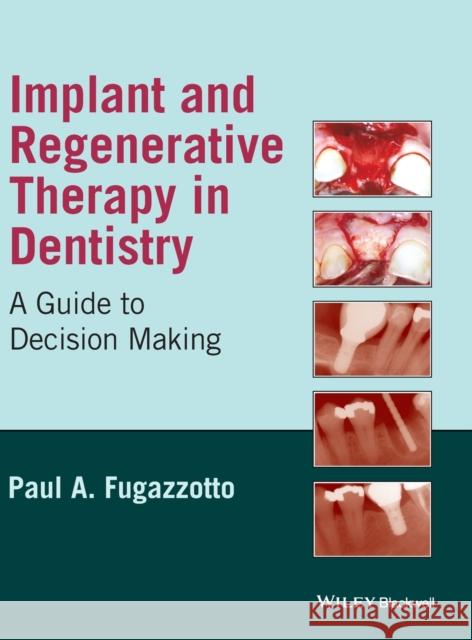 Implant and Regenerative Thera Fugazzotto, Paul A. 9780813829623 Wiley-Blackwell
