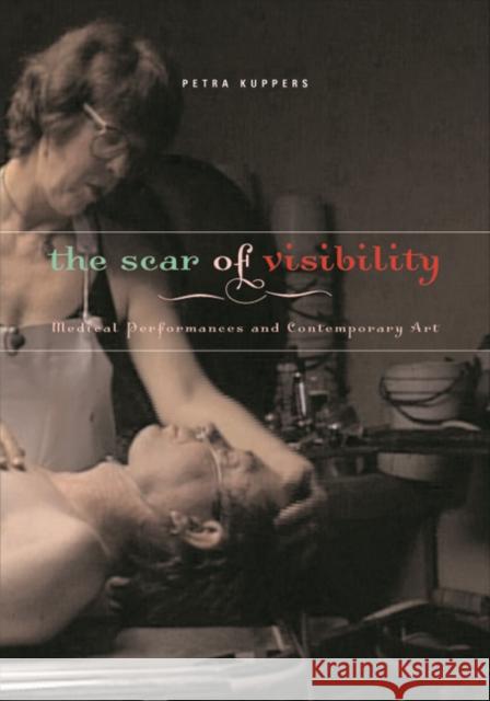 The Scar of Visibility: Medical Performances and Contemporary Art Kuppers, Petra 9780816646531 University of Minnesota Press