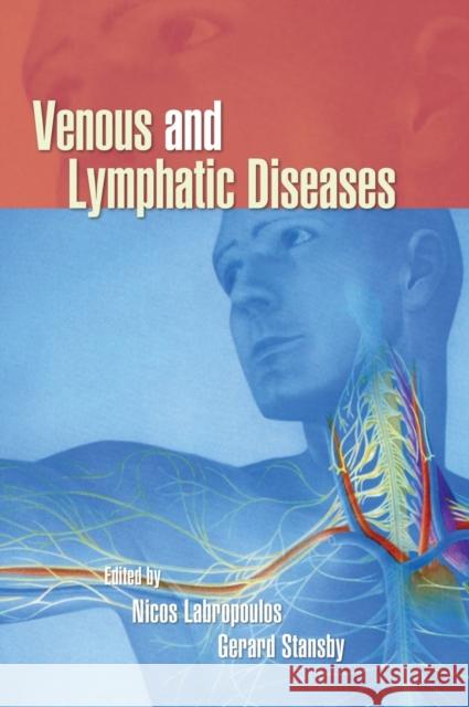 Venous and Lymphatic Diseases Nicos Labropoulos Gerard Stansby 9780824729233 Taylor & Francis