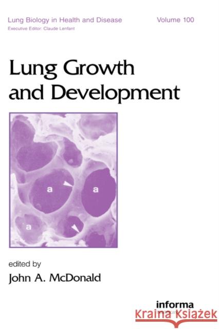 Lung Growth and Development McDonald                                 John A. McDonald 9780824797720 Informa Healthcare