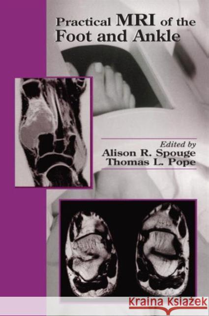 Practical MRI of the Foot and Ankle Alison R. Spouge Thomas L. Pope Thomas Lee Pope 9780849302817 CRC Press