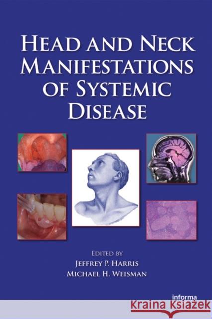 Head and Neck Manifestations of Systemic Disease Jeffrey P. Harris Michael H. Weisman 9780849340505 Informa Healthcare